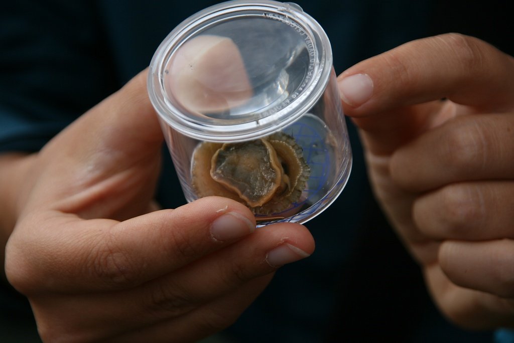 patelle déprimée patella depressa